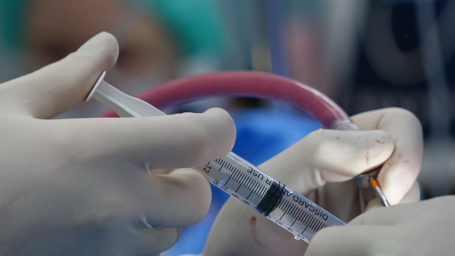 midline paracentesis